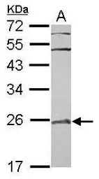 Anti-RAB7L1 antibody [N1C3-2] used in Western Blot (WB). GTX117740