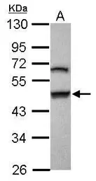 Anti-Gasdermin B antibody [N1C1] used in Western Blot (WB). GTX117760