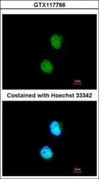 Anti-LSM4 antibody [N1C3] used in Immunocytochemistry/ Immunofluorescence (ICC/IF). GTX117766