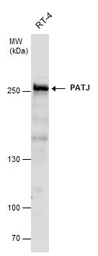 Anti-PATJ antibody [N1N2], N-term used in Western Blot (WB). GTX117767