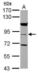 Anti-RASEF antibody [N2C1], Internal used in Western Blot (WB). GTX117779