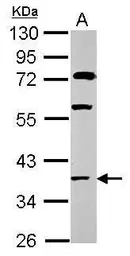 Anti-HOXC13 antibody used in Western Blot (WB). GTX117789