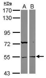 Anti-ASB3 antibody [N3C3] used in Western Blot (WB). GTX117802