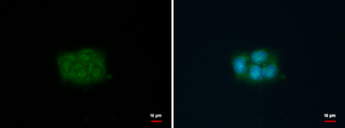 Anti-Fascin 1 antibody used in Immunocytochemistry/ Immunofluorescence (ICC/IF). GTX117805