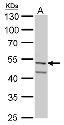 Anti-Fascin 1 antibody used in Western Blot (WB). GTX117805