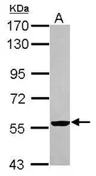 Anti-Cytokeratin 2 antibody used in Western Blot (WB). GTX117806