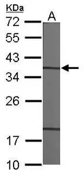 Anti-CAPZA1 antibody [N1C3] used in Western Blot (WB). GTX117813