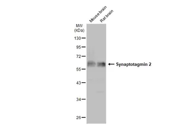 Anti-Synaptotagmin 2 antibody used in Western Blot (WB). GTX117819