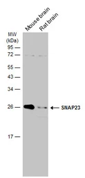Anti-SNAP23 antibody used in Western Blot (WB). GTX117823
