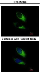 Anti-SNAP23 antibody used in Immunocytochemistry/ Immunofluorescence (ICC/IF). GTX117823