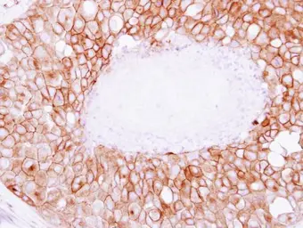 Anti-SNAP23 antibody used in IHC (Paraffin sections) (IHC-P). GTX117823