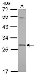 Anti-SNAP23 antibody used in Western Blot (WB). GTX117823