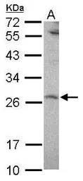 Anti-SENP8 antibody [N1C3] used in Western Blot (WB). GTX117839
