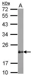 Anti-CSRP2 antibody [N1C3] used in Western Blot (WB). GTX117848