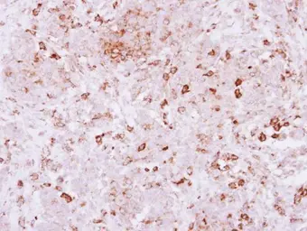 Anti-SPRED2 antibody used in IHC (Paraffin sections) (IHC-P). GTX117851