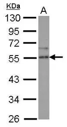 Anti-SPRED2 antibody used in Western Blot (WB). GTX117851