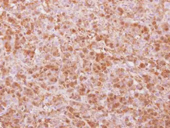 Anti-COPS4 antibody [N3C3] used in IHC (Paraffin sections) (IHC-P). GTX117852