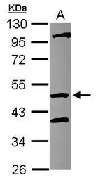 Anti-COPS4 antibody [N3C3] used in Western Blot (WB). GTX117852