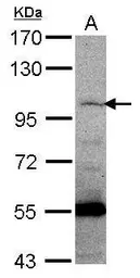 Anti-PCDHGC5 antibody [N1N3] used in Western Blot (WB). GTX117874