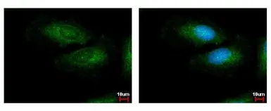 Anti-LRG1 antibody used in Immunocytochemistry/ Immunofluorescence (ICC/IF). GTX117875