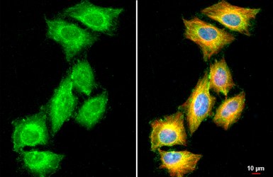 Anti-CHRDL1 antibody used in Immunocytochemistry/ Immunofluorescence (ICC/IF). GTX117884