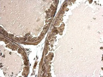 Anti-TWSG1 antibody used in IHC (Paraffin sections) (IHC-P). GTX117899