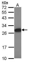 Anti-Tesmin antibody [N1C1] used in Western Blot (WB). GTX117915