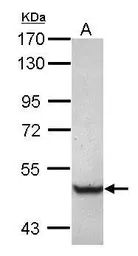 Anti-TRIM68 antibody [C1C3] used in Western Blot (WB). GTX117922