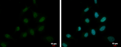 Anti-DEPDC1 antibody [C2C3], C-term used in Immunocytochemistry/ Immunofluorescence (ICC/IF). GTX117924