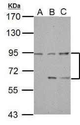 Anti-DEPDC1 antibody [C2C3], C-term used in Western Blot (WB). GTX117924
