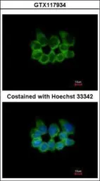 Anti-RPL8 antibody used in Immunocytochemistry/ Immunofluorescence (ICC/IF). GTX117934