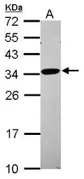 Anti-RPL8 antibody used in Western Blot (WB). GTX117934