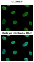 Anti-SENP3 antibody used in Immunocytochemistry/ Immunofluorescence (ICC/IF). GTX117938