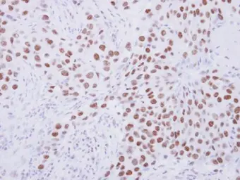 Anti-SENP3 antibody used in IHC (Paraffin sections) (IHC-P). GTX117938