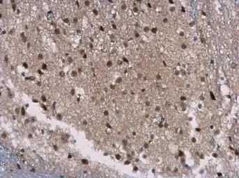 Anti-SIRT7 antibody [N2C3] used in IHC (Paraffin sections) (IHC-P). GTX117939