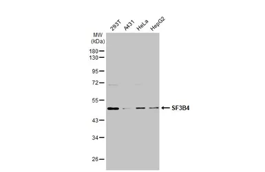 Anti-SF3B4 antibody used in Western Blot (WB). GTX117942