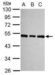 Anti-SF3B4 antibody used in Western Blot (WB). GTX117942