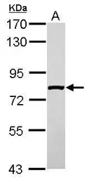 Anti-SLC4A1AP antibody used in Western Blot (WB). GTX117943