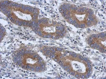 Anti-TRIM15 antibody [N2C2], Internal used in IHC (Paraffin sections) (IHC-P). GTX117947