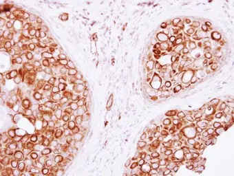 Anti-VAM1 antibody [N3C3] used in IHC (Paraffin sections) (IHC-P). GTX117969