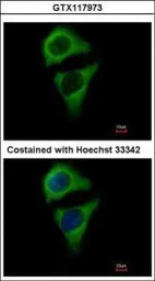 Anti-ASB8 antibody used in Immunocytochemistry/ Immunofluorescence (ICC/IF). GTX117973