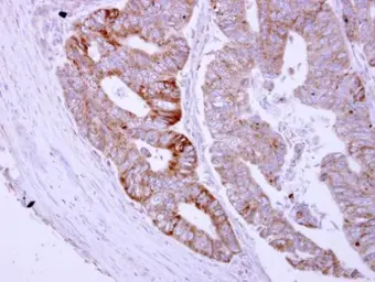 Anti-ASB8 antibody used in IHC (Paraffin sections) (IHC-P). GTX117973
