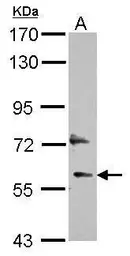 Anti-DEPDC7 antibody used in Western Blot (WB). GTX117979