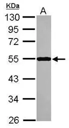 Anti-SEPT10 antibody [N3C3] used in Western Blot (WB). GTX117982