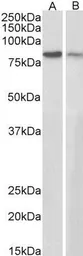Anti-gamma Catenin antibody, C-term used in Western Blot (WB). GTX11799