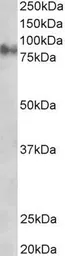 Anti-gamma Catenin antibody, C-term used in Western Blot (WB). GTX11799