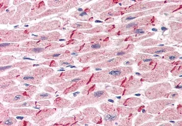 Anti-gamma Catenin antibody, C-term used in IHC (Paraffin sections) (IHC-P). GTX11799