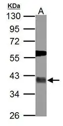Anti-USP46 antibody used in Western Blot (WB). GTX117994