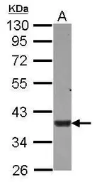 Anti-USP46 antibody used in Western Blot (WB). GTX117994