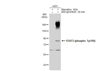 Anti-STAT3 (phospho Tyr705) antibody used in Western Blot (WB). GTX118000